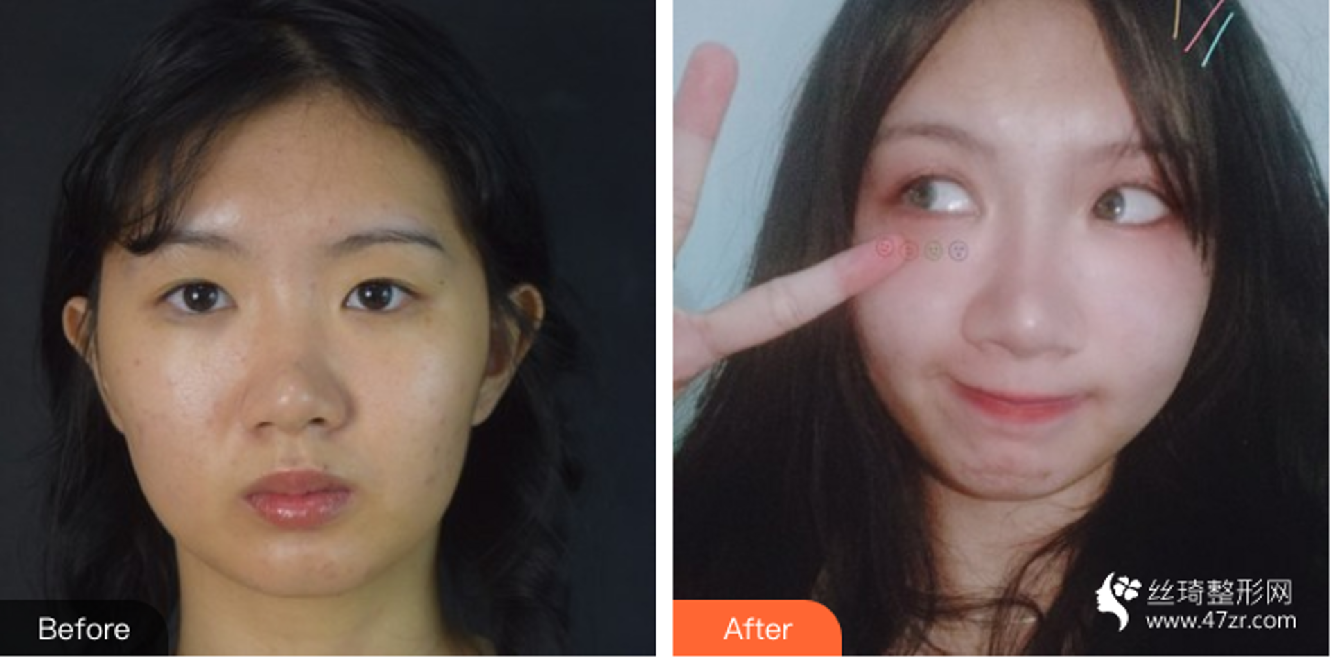 润泽瑞尼丝医美
